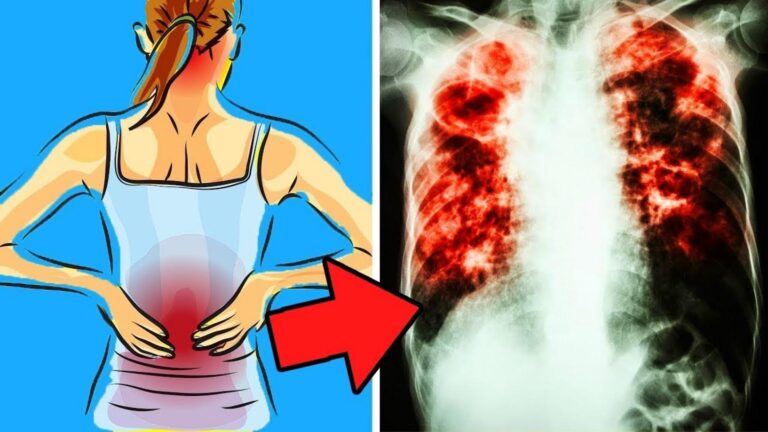 Cette astuce simple révèle des signes cachés d’une pneumonie à ne pas ignorer…